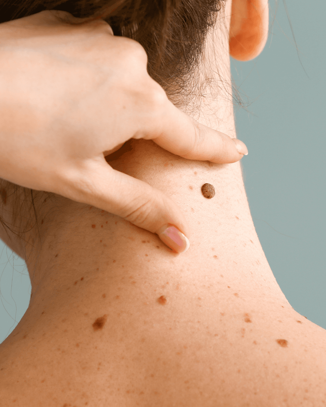 Eliminación definitiva