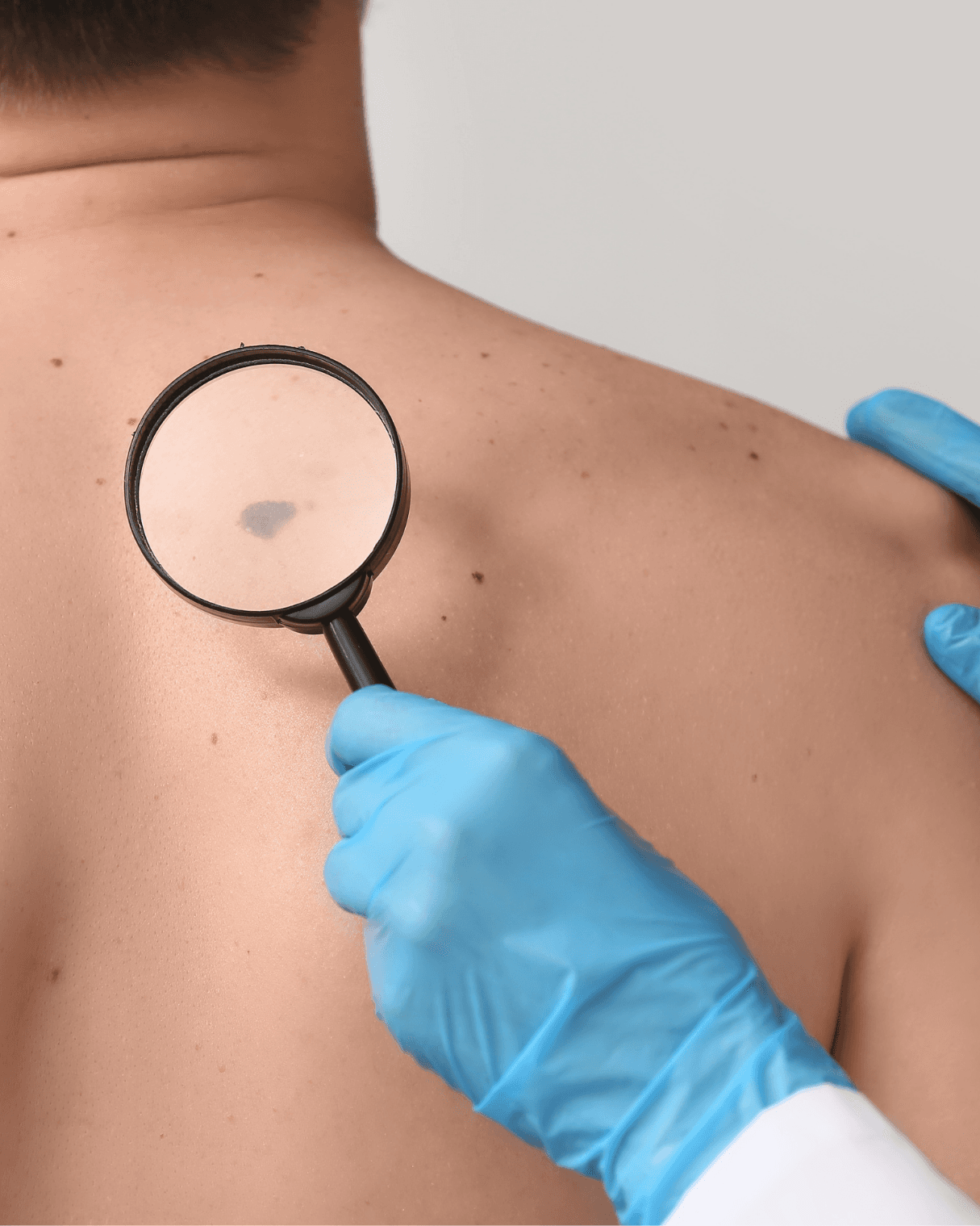 Procedimiento seguro y preciso